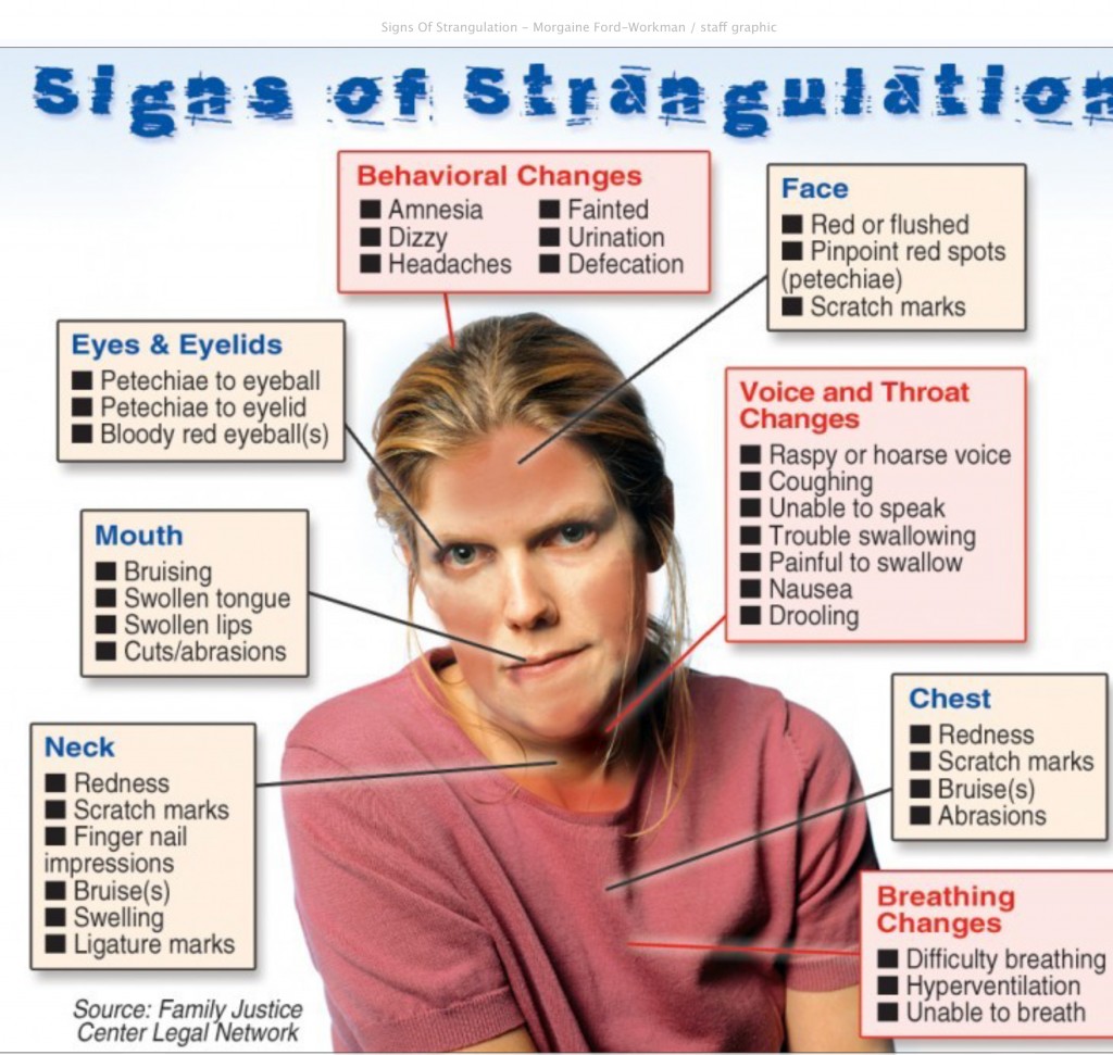 Life and Death in Your Hands: Strangulation more common in domes